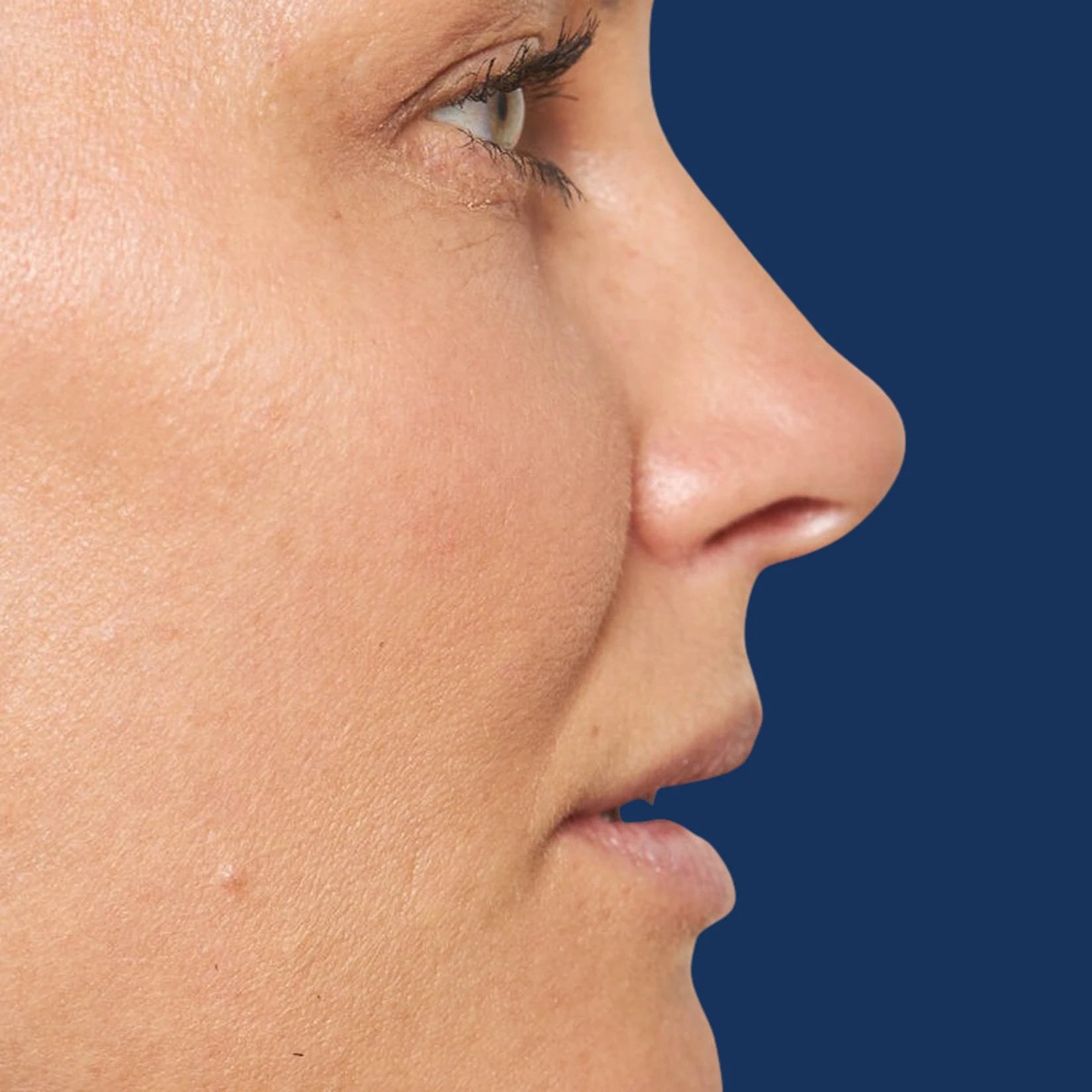 injectables
